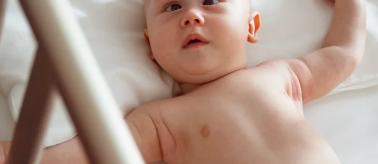 Bebeklerde Şaşılık